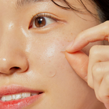 Acne Pimple Master Patch